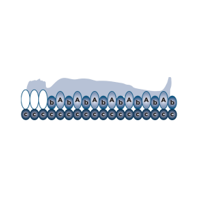 Alerta Bariatric 2 Replacement System, High-Capacity Pressure Relief for Bariatric Users